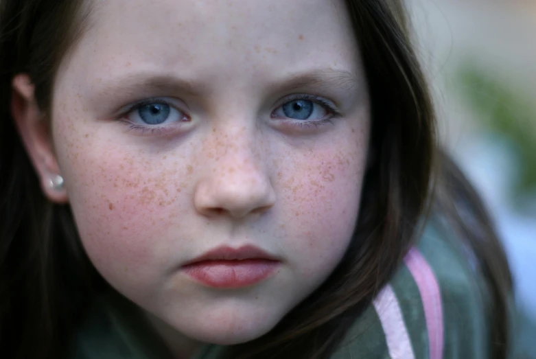 the girl's freckled face is brown and pink