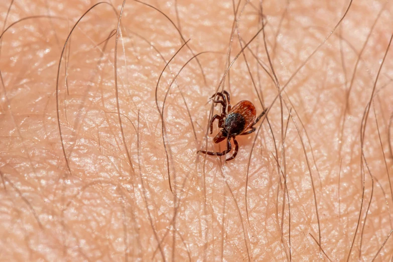 a spider that is crawling around its human skin