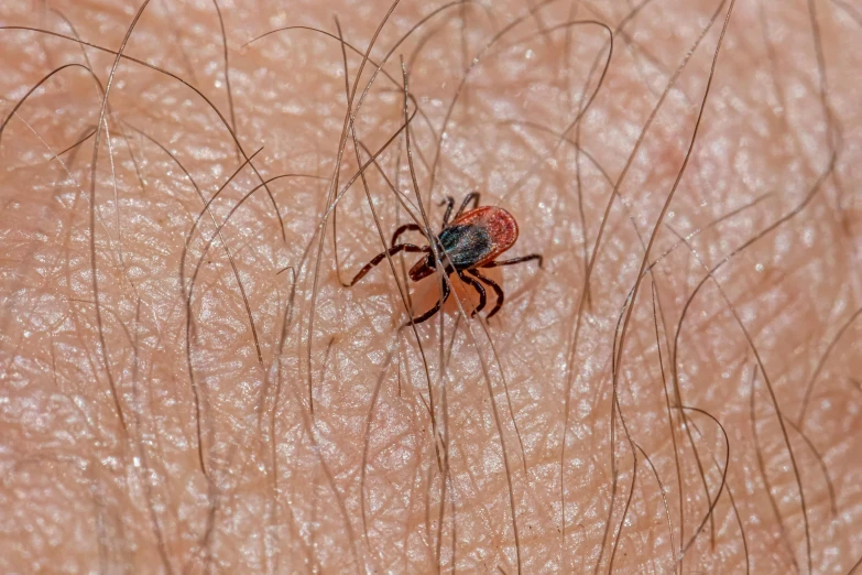 a spider sits on the arm of a mans arm