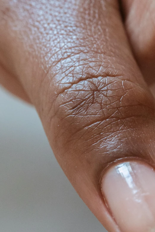 the small nail is in the middle of a thumb