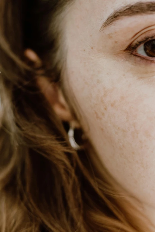 woman with freckles on her face looking into camera