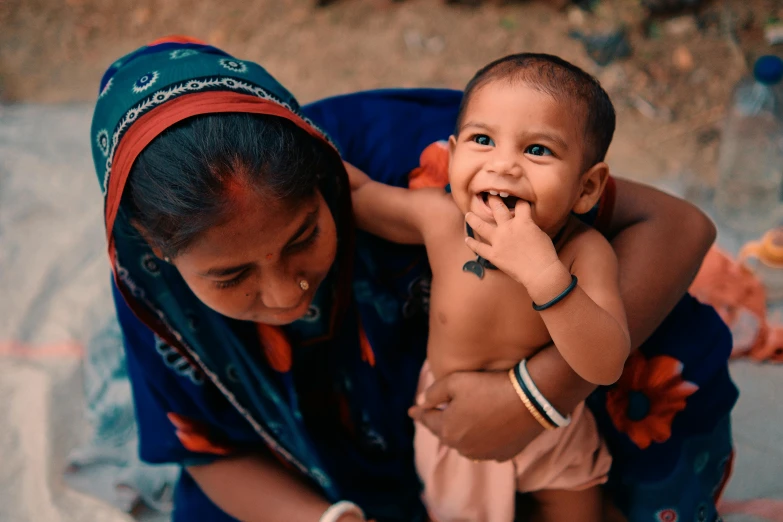 a child with a large  being held in his mother's arms