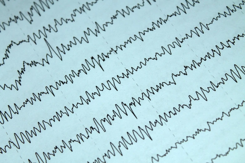 a close up of a sheet of paper with lines, happening, lysergic, earthquake, photo illustration, medical