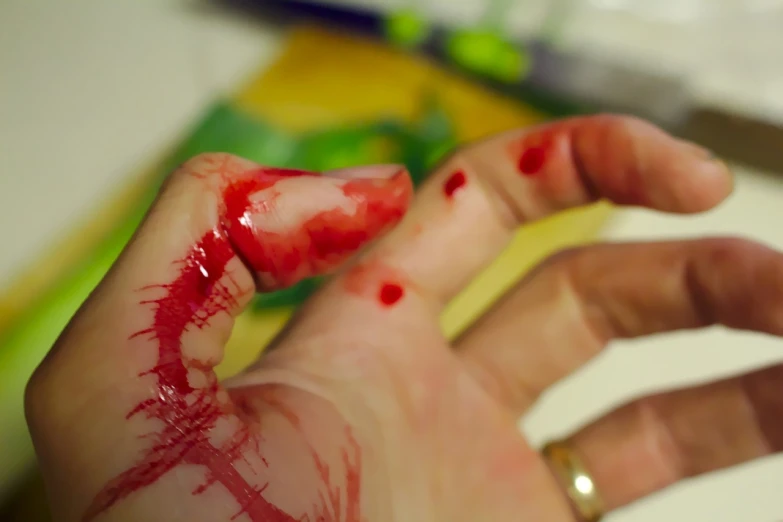 a close up of a person's hand with blood on it, a picture, chopping hands, self deprecating, close angle, rubbery