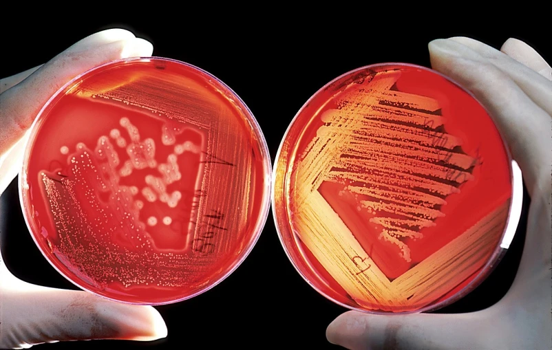 a close up of two hands holding a petri dish, a microscopic photo, by Alexander Fedosav, red liquid, front and back view, fungal pages, ap photo