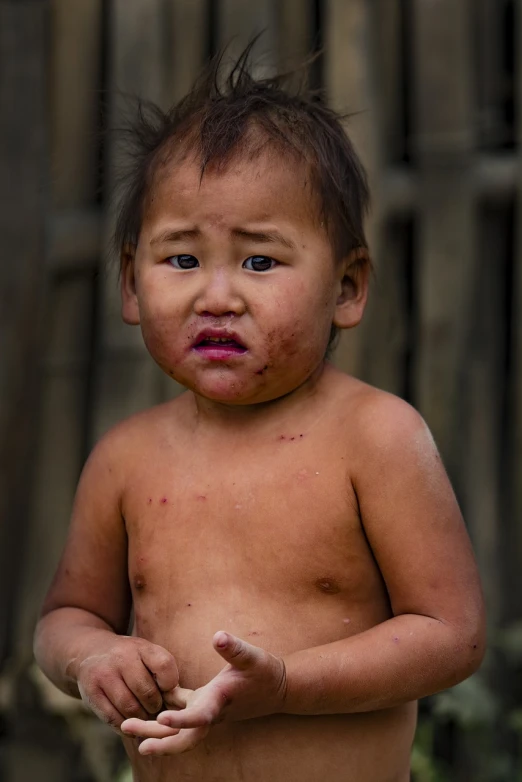 a small child standing in front of a wooden fence, a portrait, by Richard Carline, sumatraism, lip scar, laos, bruised, nipple