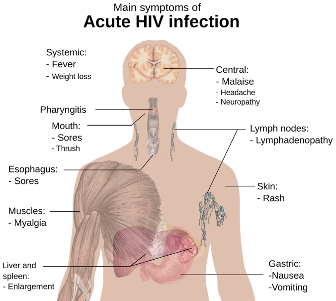 a diagram of the anatomy of the human body, a digital rendering, digital collage, head and upper body only, dread + highly detailed, top half of body