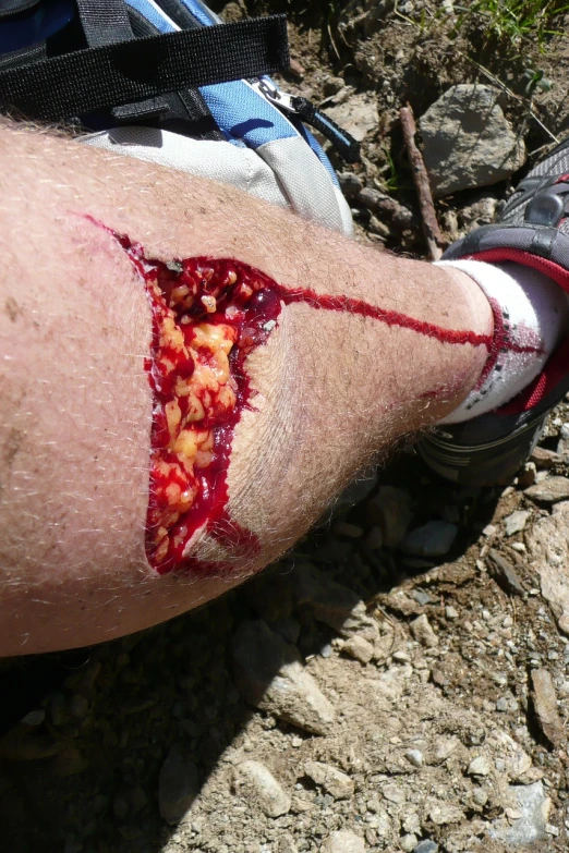 a close up of a person with a wound on their leg, a photo, by Kurt Trampedach, hurufiyya, cut into the side of a mountain, very very happy!, partially bloody crystallized, greg