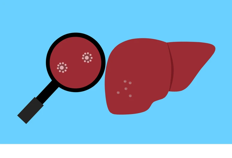 a panoramic view of a liver and a magnifying lou lou lou lou lou lou lou lou lou lou lou lou lou lou lou, an illustration of, pixabay, hurufiyya, diagnostics, wikihow illustration, side view close up of a gaunt, getty images