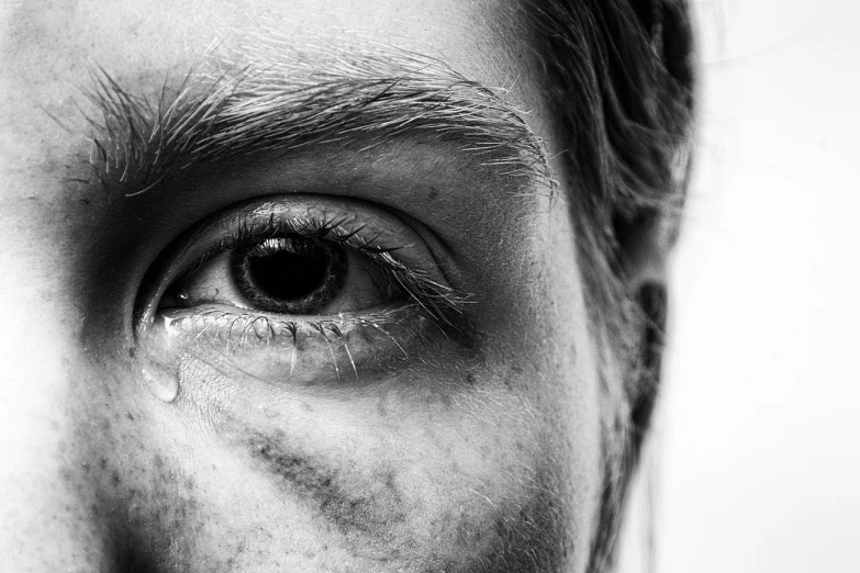 a black and white photo of a man's eye, by Matija Jama, pexels, hyperrealism, woman crying, half face, woman with freckles, hyperrealistic flickr:5