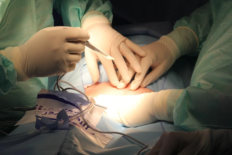 a surgeon is performing an operation on a patient, a picture, by Kurt Roesch, shutterstock, light emitting from fingertips, photos, 3 4 5 3 1, palladium veins