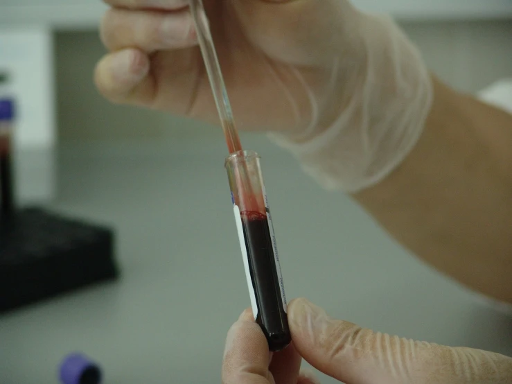 a close up of a person holding a tube of blood, a photo, laboratory, medium wide shot, tuning, screen cap