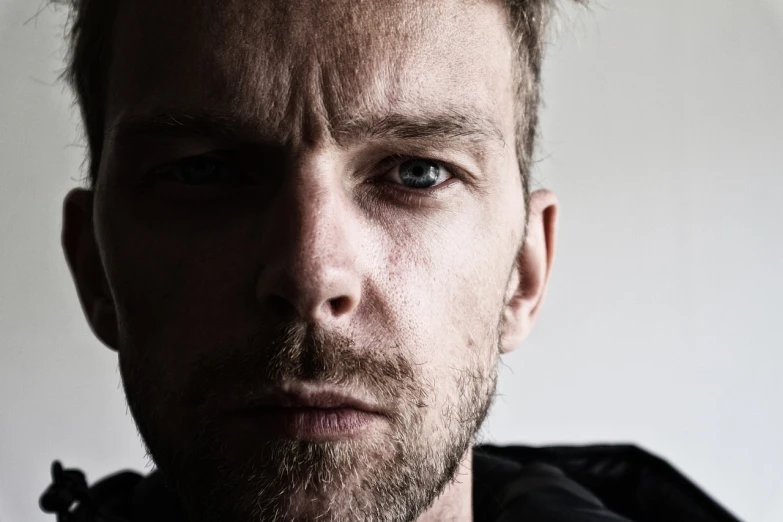 a close up of a man with a beard, inspired by Hallsteinn Sigurðsson, digital art, angry looking at camera, depressed sad expression, boyish face, 3 2 - year - old man