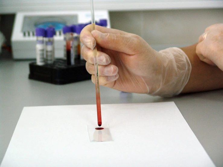 a close up of a person holding a tube of blood, a photo, color degragation, istockphoto, tending on arstation, vertical orientation