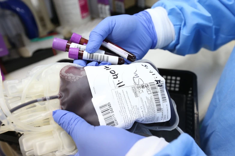 a person in blue gloves holding a bag of blood, a photo, purple and red color bleed, 834779519, ap photo, diagnostics