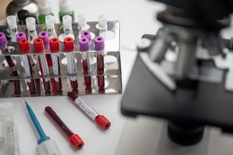 a microscope that is sitting on top of a table, blood collection vials, afp, [[blood]], purple and scarlet colours
