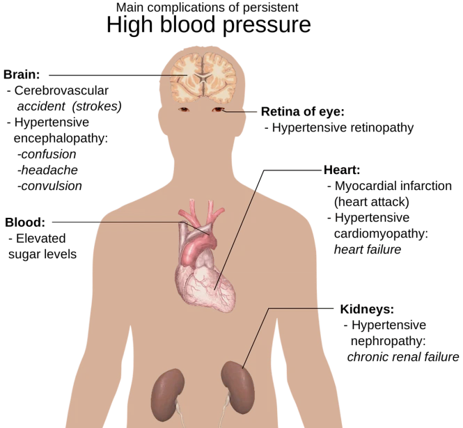 a diagram of the anatomy of the human body, a digital rendering, miniature human brain, heart operation, man is with black skin, wikihow illustration