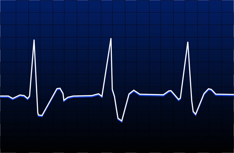 a graph shows the decline in heart rate since the corona