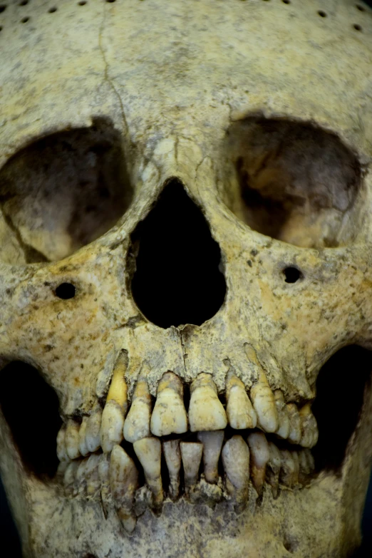 an old human skull with no jawbone visible