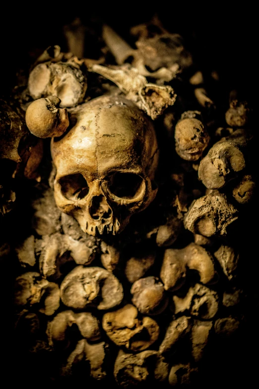 an image of skull and bones on a black background