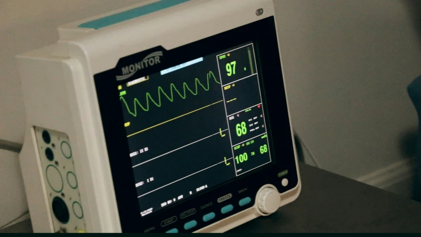 a monitor with an ecg or chest of  in it