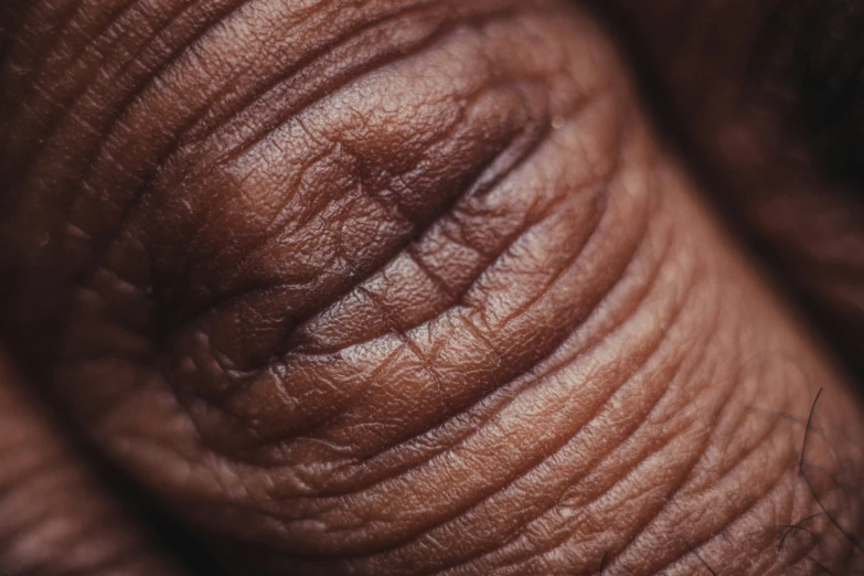 a close up view of an elephant's skin with small patches