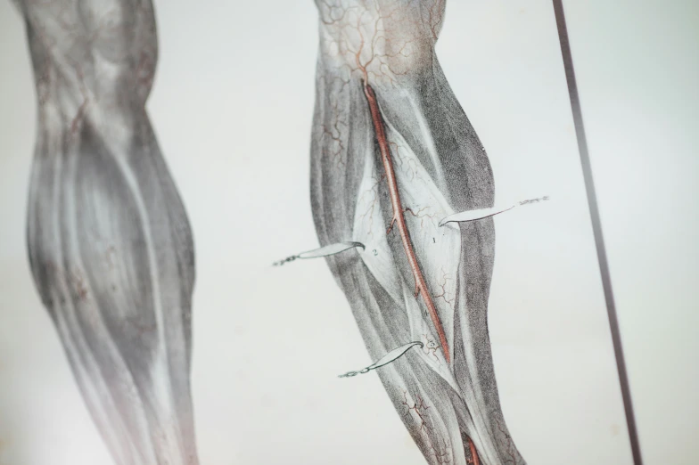 an anatomy pograph shows the location of bones and  vessels