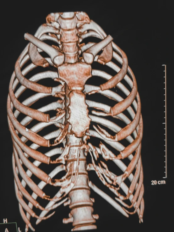 a view of the rib cage in an x - ray image
