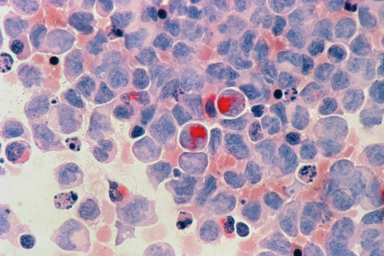 cells in purple and pinks are displayed in a microscope