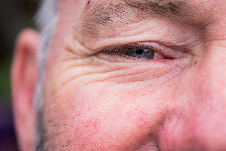 a man's eyes and hair show no signs of wrinkles