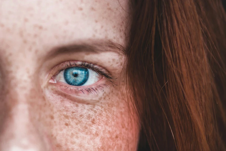 a woman with frecky skin is looking at the camera