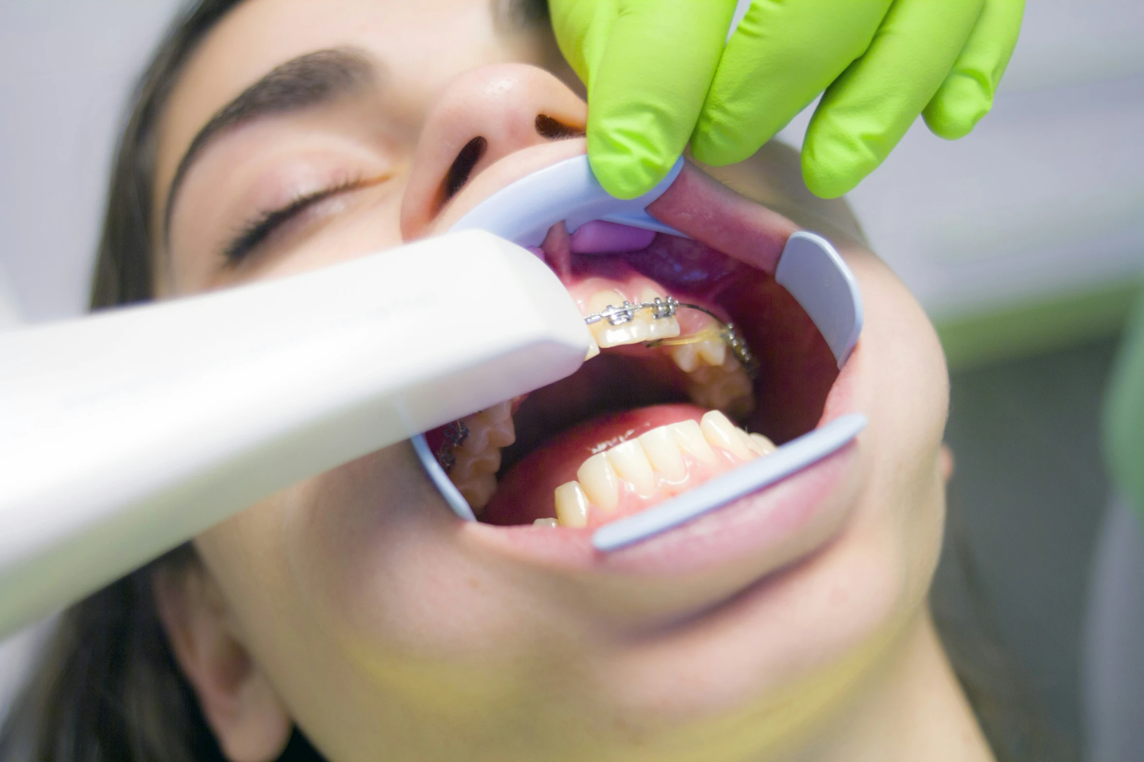 a woman getting a ce with her teeth and a toothbrush