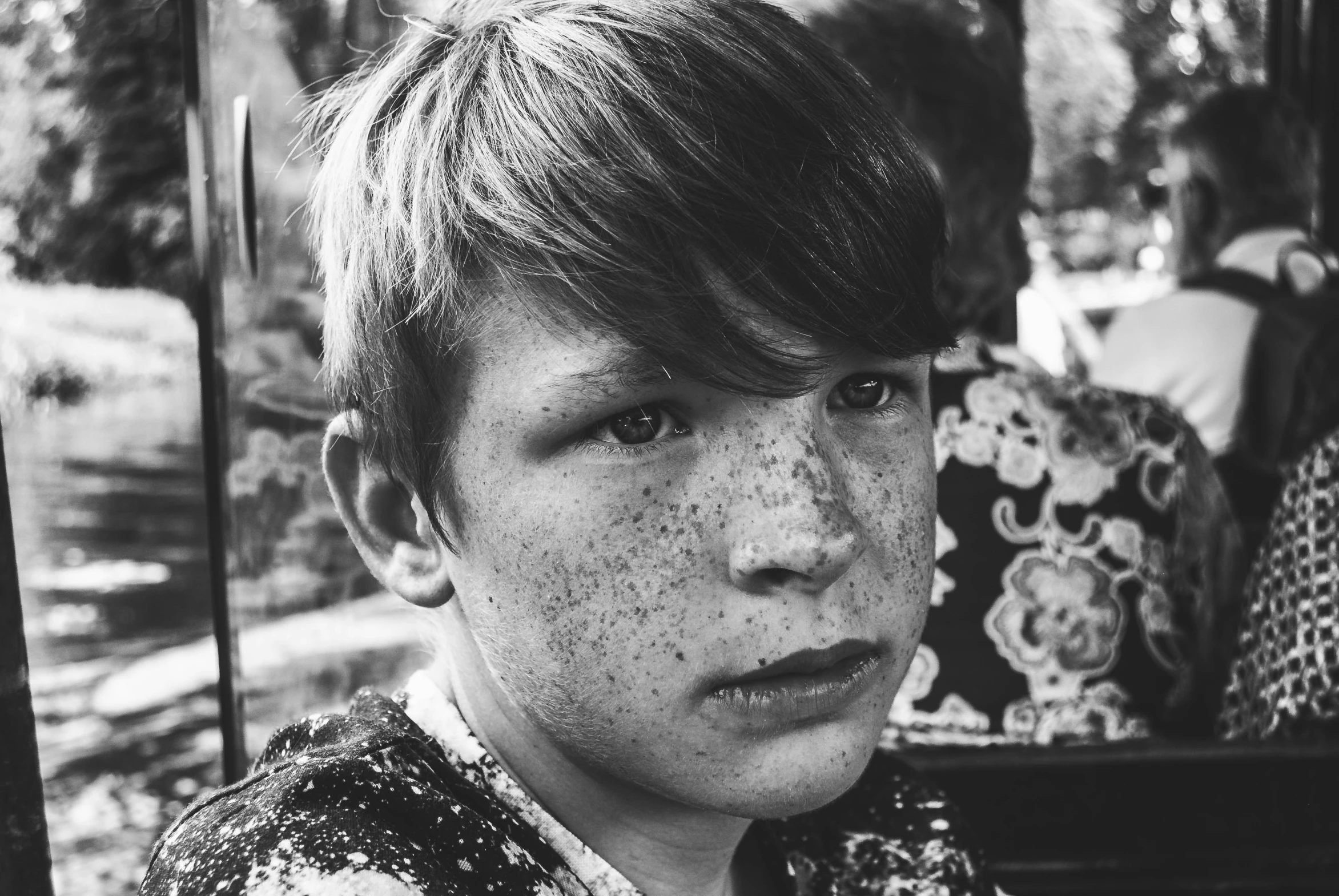 a boy with spots on his face and back half