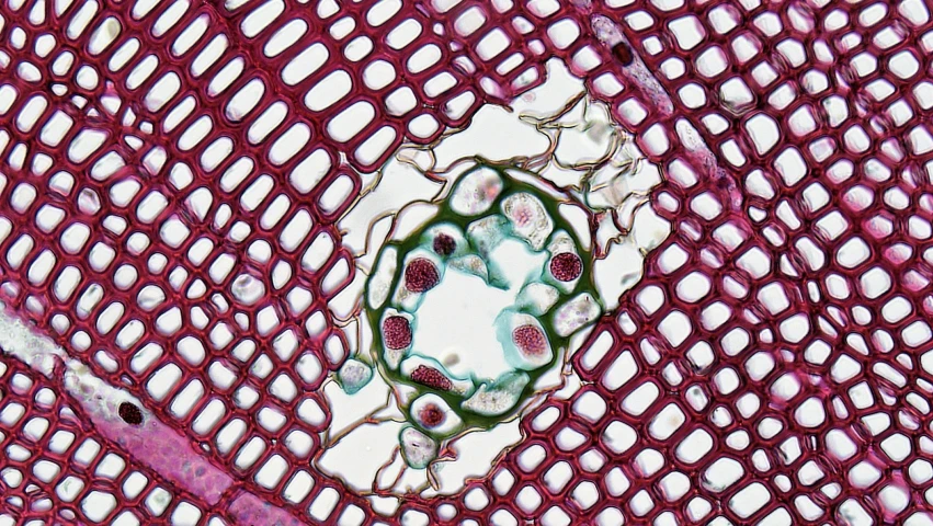  cells, which have a unique appearance, are visible in this pograph