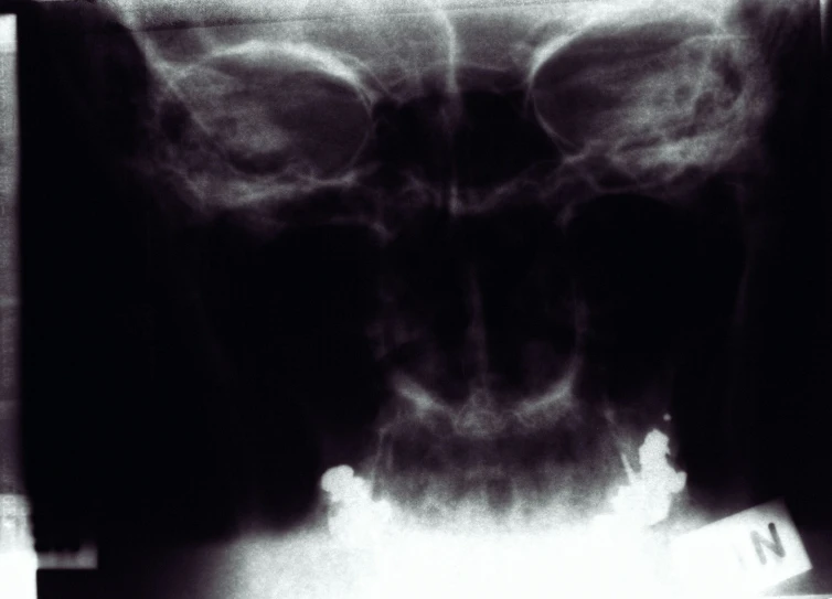 a x - ray image of the face of a human