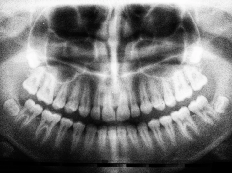 a black and white pograph of a mouth