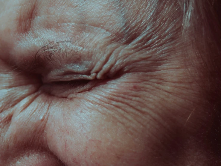 an old woman's eye, showing wrinkles