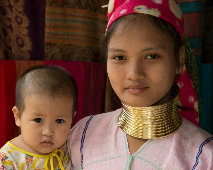 an asian girl with a neck collar poses with her baby