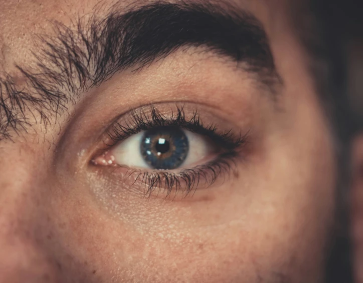 a close up s of a male eye with small patches on the iris