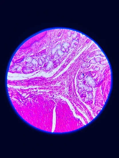 the purple, pink and yellow structure of a vein