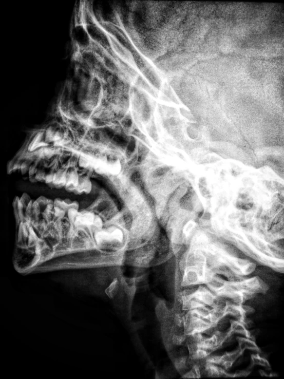 a cross - section x - ray of someone's face and arm