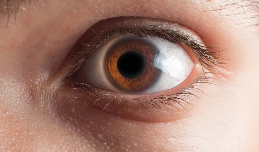 an eye with orange iris with white iris