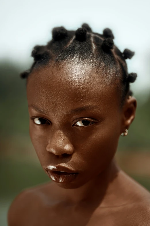 a girl with dark skin with white spots