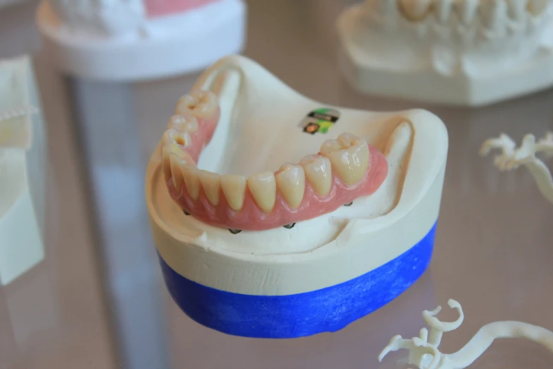 a close up of a model of a mouth with dent lines