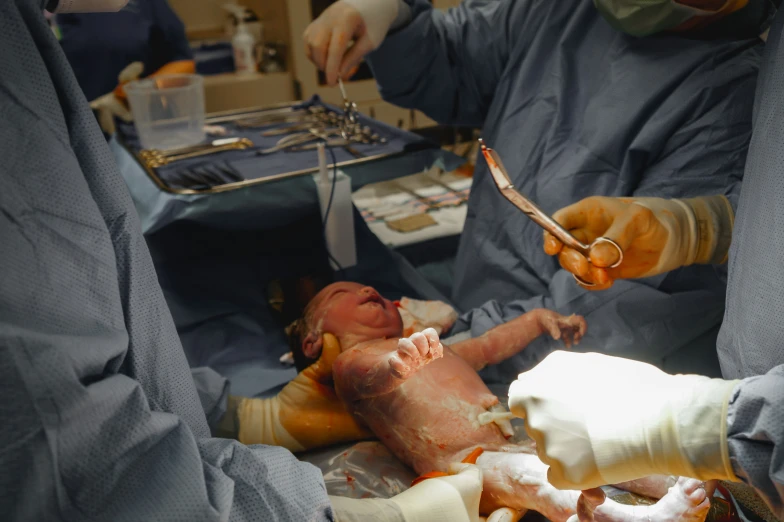 a baby laying down in the middle of a  procedure