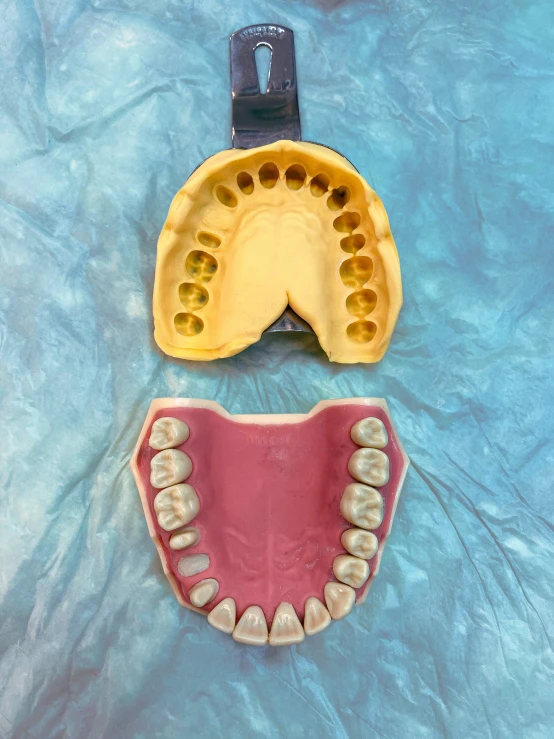 an open mouth with a missing tooth and a partial lower jaw