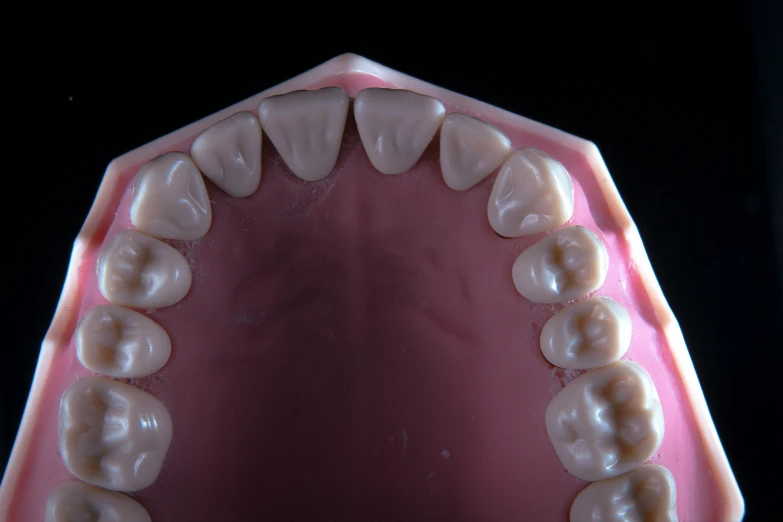 a view of a dental model showing the missing teeth