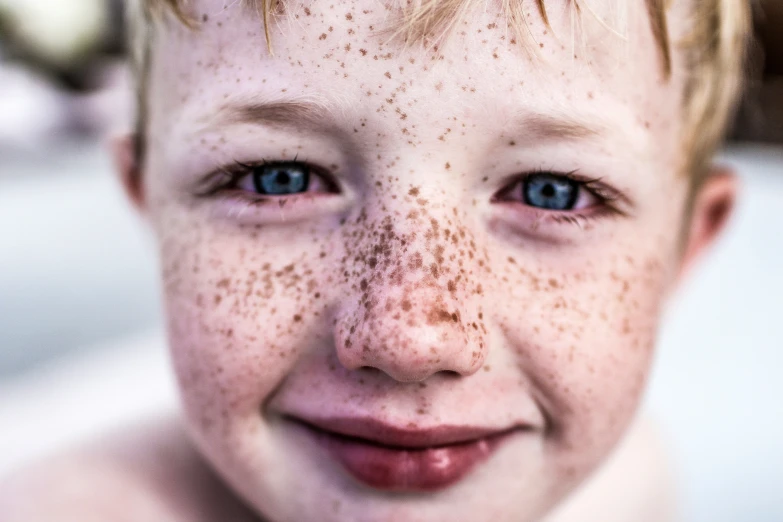 a boy smiles at the camera with freckled blue eyes