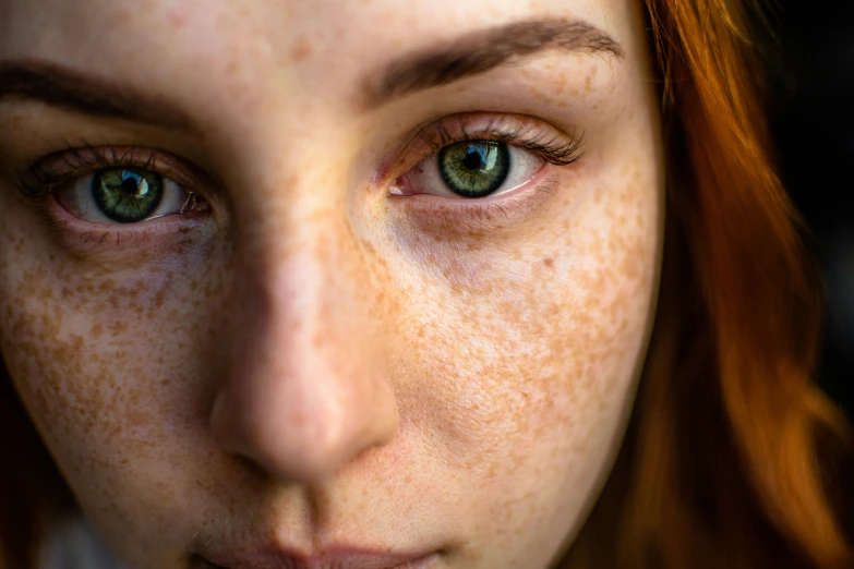 a close up po of a woman's face and freckles