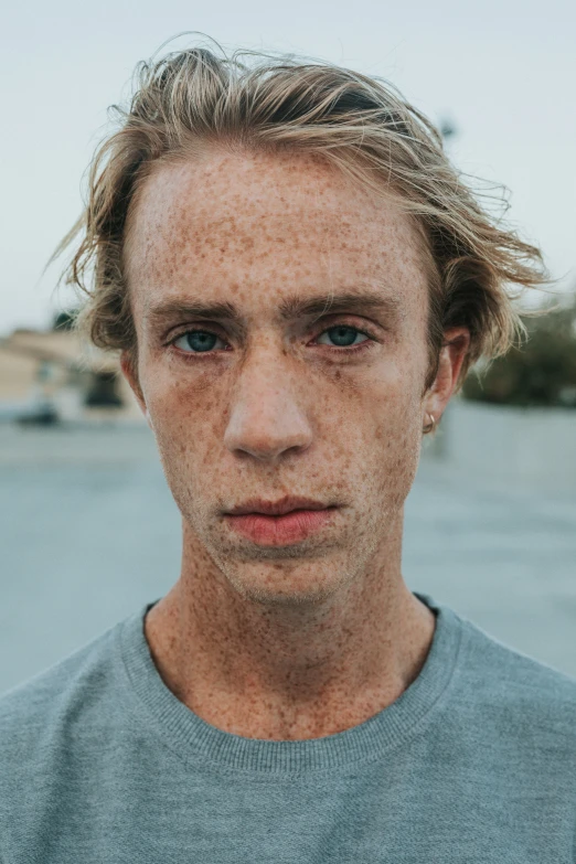 this is a pograph of a young man with freckles on his face